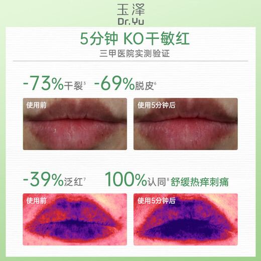 Dr.Yu Skin Barrier Repair Specialized Moisturizing Lip Essence 10g Soothes, Anti-Wrinkle and Firms