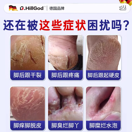 Dr.HillGod's Athlete's Foot Anti-Itching Peeling Rotten Feet Fungal Infection Itchy Sweating Feet Special Medicinal Cracked Foot Cream Heel Dry Cracked Single Box Special Effects