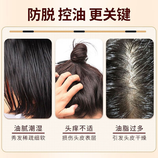 Bawang anti-hair loss shampoo, oil control, anti-dandruff, refreshing, fluffy, nourishing, strong roots, solid hair, anti-hair loss shampoo for men and women, hair growth shampoo 380ml + hair growth serum 60ml
