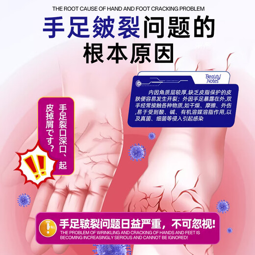 BEAUTY NOTES Cracked Cream Hand and Foot Anti-Crack Cream Cracked Feet Cracked Hands Cracked Heels Cracked Skin Cream Cracked Foot Cream 80g