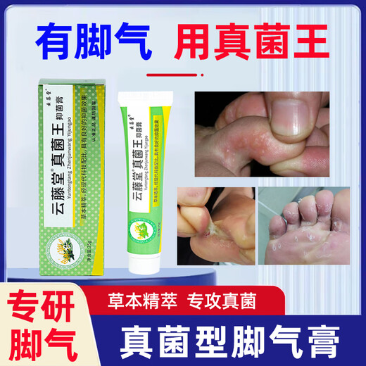 VKR Powerful Fungus King Athlete's Foot Cream Fungus Infected Feet Peeling, Erosion, Blisters, Sore Feet, Sweaty Feet, Odorful Feet Itching. Buy 2 shots and 3 boxes to eradicate the roots. Only spend 2 boxes.