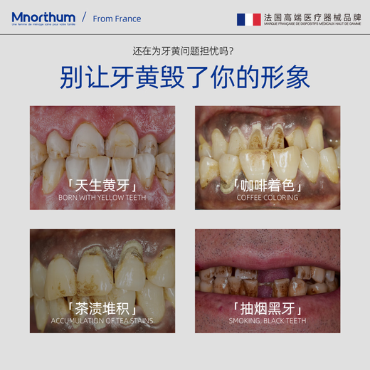 Mannosen Whitening Teeth Patches Whitening Teeth Yellow Teeth Stains Smoke Stains Remove Yellow Stains Remove Bad Breath Temperature and No Acid Teeth Portable [7 Days of Temperature Brightening] 14 Patches/Box