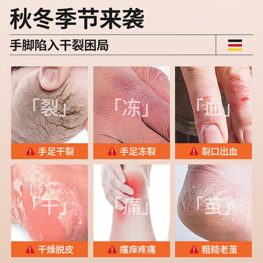 DAGO horse oil hand cream hydrates and moisturizes, improves dryness, moisturizes and prevents dryness, large-capacity hand cream for men and women