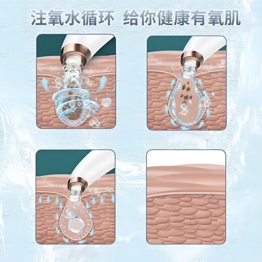 Xiaomi Baby Series New Small Bubble Blackhead Absorber Home Facial Beauty Instrument Pore Acne Cleaning White Flagship Model Strictly Selected Quality