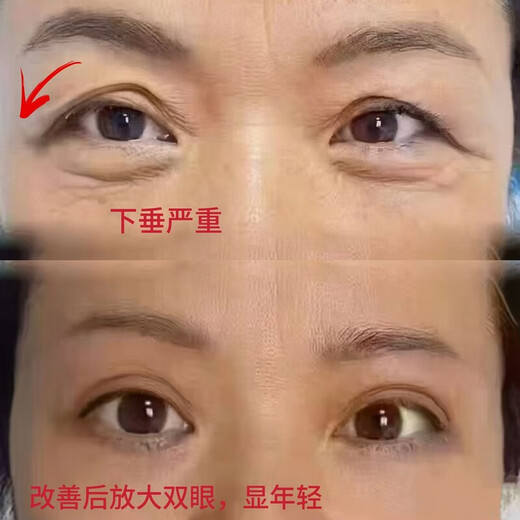 New product, anti-sagging double eyelid patch for sagging eyelids, invisible traceless lace, sticky when exposed to water, strong waterproof for both eyes, anti-eyelid 30 pieces, 600 pieces