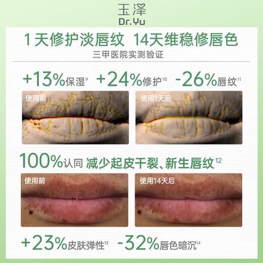 Dr.Yu Skin Barrier Repair Specialized Moisturizing Lip Essence 10g Soothes, Anti-Wrinkle and Firms
