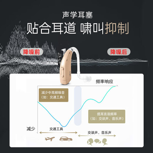 Siemens Germany imported genuine hearing aid for the elderly, special for behind-the-ear deafness, high-power intelligent noise reduction, extra-ear HPTHERR 72 channels + remote debugging + intelligent noise reduction + customized eardrum