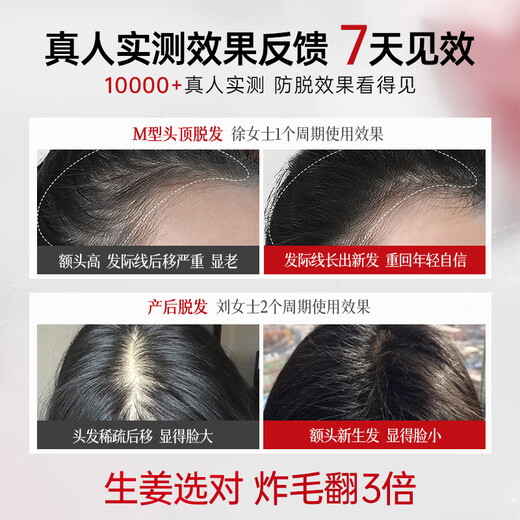 ZHENMI新加坡进口洗发水防脱育发生姜固发去屑防掉断发控油金榜第1名