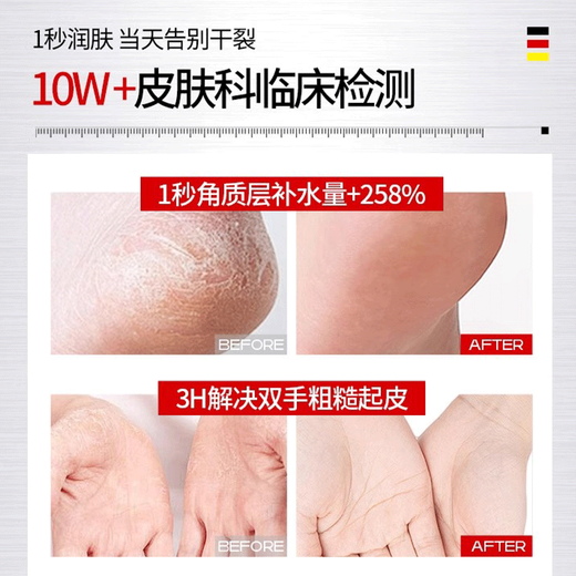 BEAI Chapped Feet Cream Heel Anti-Dry Cracks Chapped Cracks Frosted Crack Cream Protects Chapped Hands and Feet Moisturizer