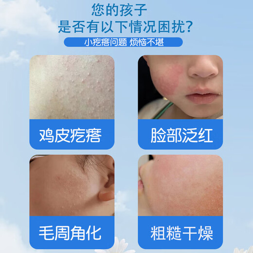 ADPWY children's skin removal artifact for small particles and pimples on children's face, special for keratosis pilaris, can be used with ointment for teenagers