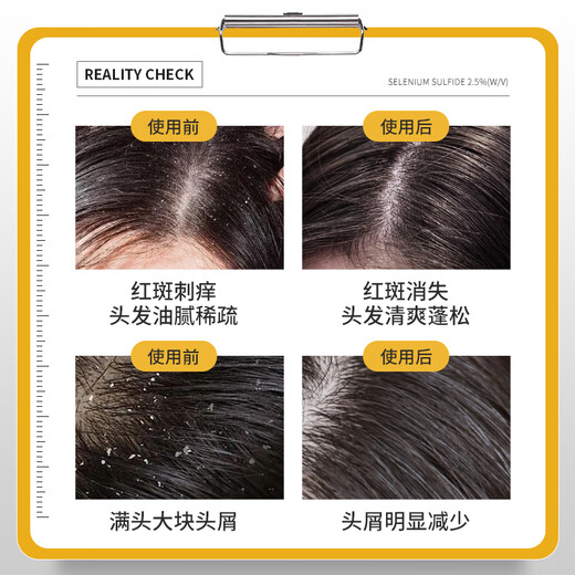 SELSUN 2.5% selenium disulfide shampoo 120ml oil control, anti-dandruff, deep cleansing and anti-itching Hong Kong imported version