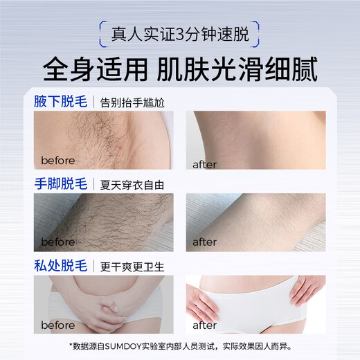 SUMDOY hair removal cream imported from Japan, private parts, men and women, non-facial, armpit hair removal, body hair removal, no black spots on hair roots, save 39 yuan, hair removal cream 100g*2