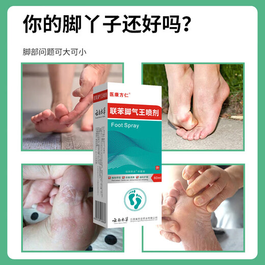 Biphenyl spray solution for athlete's foot, anti-itching, peeling and blisters, sterilizing athlete's foot, deodorizing, anti-bacterial and anti-fungal, quickly relieving itching and eradicating it, consolidated pack of 60ml*5 bottles