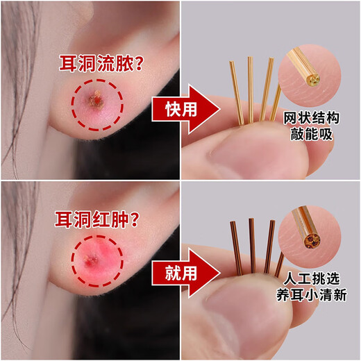 Yanru decorated tea stem ear sticks to support ear piercings and earrings for female students, invisible earrings, anti-blocking needles, anti-inflammatory ear sticks, washable and sleep-free earrings, E4038, 20 pieces, small size, trial pack