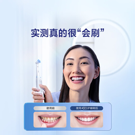 Oral-B Li Jiaqi's same model smart electric toothbrush iO3plus extreme white brush head * 2 root cleansing national subsidy OCC Jingdong gold list birthday gift gift