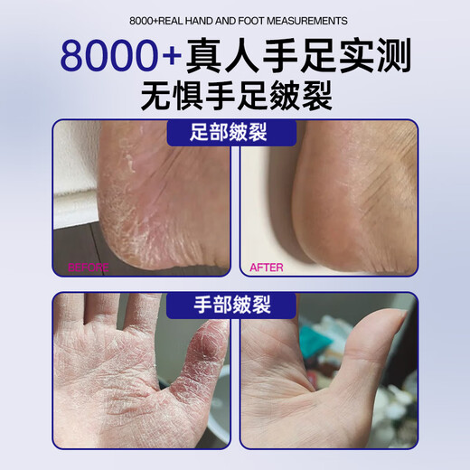 BEAUTY NOTES Cracked Cream Hand and Foot Anti-Crack Cream Cracked Feet Cracked Hands Cracked Heels Cracked Skin Cream Cracked Foot Cream 80g