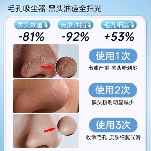 Xu Lin, Germany, blackhead suction instrument, super large suction cleaner, electric blackhead suction, acne shrinking pores, household small bubble beauty instrument, acne removal artifact, electric blackhead instrument, new supreme model, free blackhead gift pack, vacuum negative pressure/multi-level adjustment