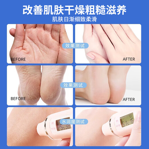 New Xile Cracked Corning genuine anti-cracking ointment Vaseline hand cream to prevent dry cracked hands, feet and heels, non-chilblain cracking and chapped