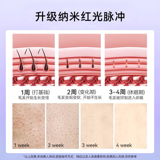 Lenovo Hair Removal Device Freezing Point Sapphire Painless Stone Ice Cream Sensation High Energy Shaving for Men and Women with Light Lips, Armpits, Legs and Private Parts Maojia Medical Whole Body Sent to Friends Qixi Festival 520 Valentine's Day Gift Quartz Crystal Version Upgraded Freezing Point + Upgraded Red Light Wave + Specialized in Removing Thick Hair