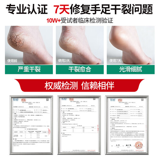 Chunchuntang Heel Cracked, Cracked and Hard Skin Soles, Hands and Feet Peeling Anti-Cracking Cream Anti-Fungal Skin Moisturizing Hand Cream
