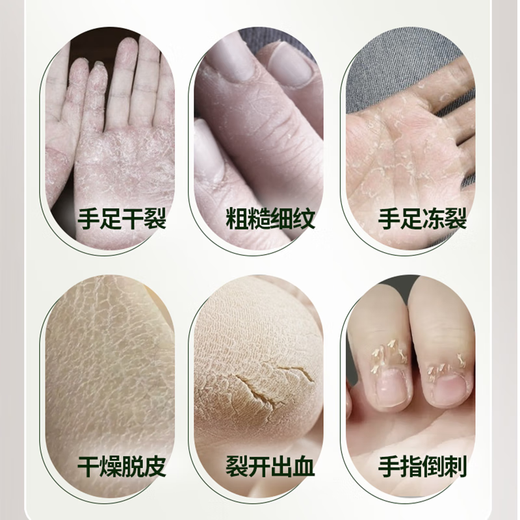 Haab Australian shea butter hand and foot cream imported long-lasting moisturizing, moisturizing, protecting against cracking, improving roughness and dullness 50g