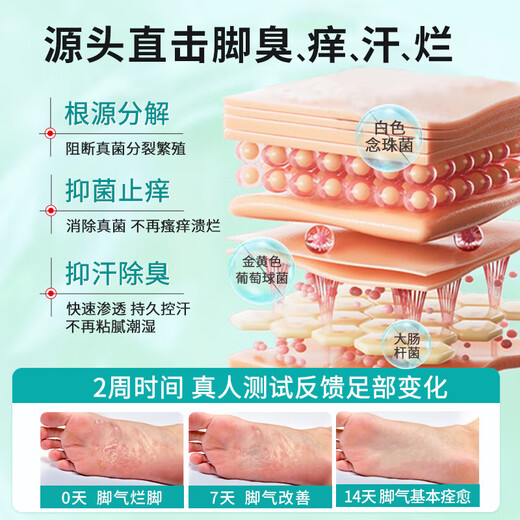 Yuentang Yunnan Herbal Athlete's Foot Spray Anti-itching Peeling, Rotten Feet, Fungal Infection Blisters, Foot Smell, Sweat Antibacterial Spray 60ml