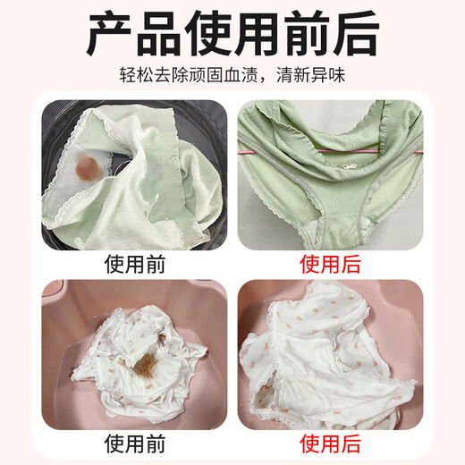 Huanke blood stain cleaner 218ml protease to remove blood stains, aunt's blood-washed sheets and underwear, powerful yellow cleaner