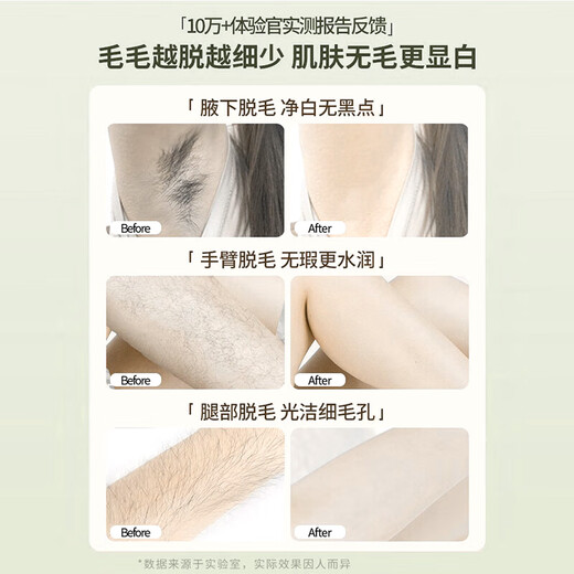 Hanzhixi Hair Removal Cream, permanent root removal, no longer growing, medical use for men and women, special for students, private armpit hair and leg hair, gentle hair removal, hospital line special research, mild hair removal cream 280g*1 bottle