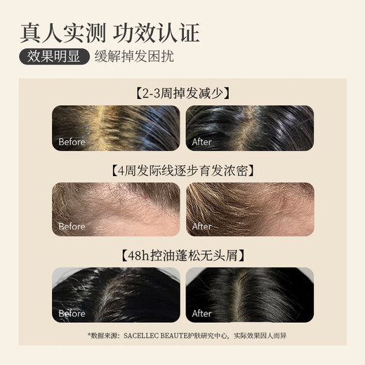 SACELLEC BEAUTE anti-degeneration ginger shampoo 400ml solid hair nourishing anti-dandruff anti-itch oil control fluffy shampoo for men and women