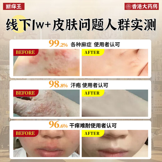 Hong Kong Pharmacy Co., Ltd. Itch-breaking King, Itch-Relieving King, Antibacterial Skin, Anal Itching, Moisturizing Scrotum, Body Itching Wolfsbane Ointment, Rash Roots for the Elderly