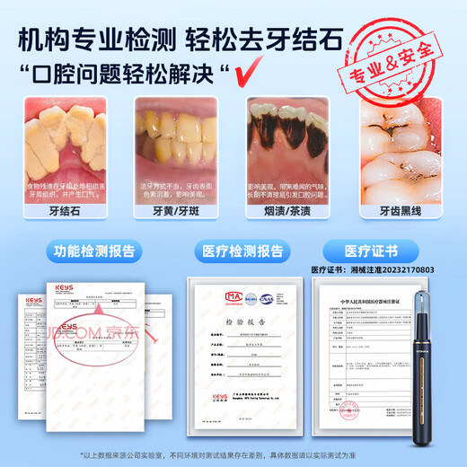 KONKA Ultrasonic Teeth Cleaner Teeth Cleaner Calculus Remover Cleans Teeth and Removes Yellow Teeth Calculus Cleaner Medical Gift Flagship Model - Galaxy Blue True Ultrasonic + Full Set of Teeth Cleaning Tools