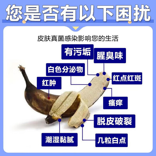 Official special medicine for balanitis, reproductive fungal infection, anti-inflammatory, pearly rash, foreskin inflammatory disease, men's private parts itching, male skin medication, erythromycin ointment, 10 boxes, Jingdong Pharmacy