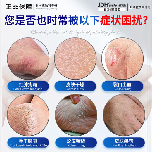 Japanese chemical medicine, 3 seconds healing, cracked foot cream, cracked heels, cracked feet, moisturizing cream, moisturizing hands and feet, preventing cracking and peeling, 1 bottle, 1 second repair