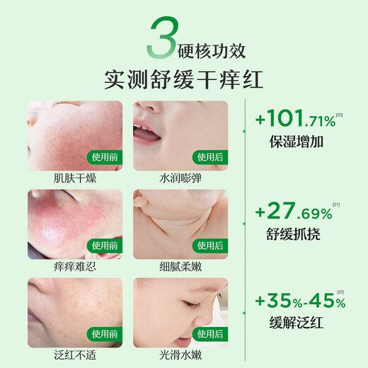 Songda children's face cream baby skin care moisturizing baby face cream moisturizing autumn and winter moisturizing camellia oil cream 68g