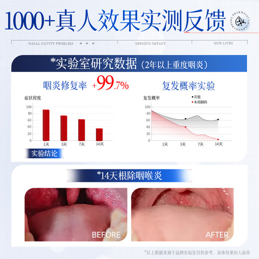 Honda Pharmaceutical Chronic pharyngitis, phlegm and cough, dry and itchy throat, dry cough, foreign body sensation, pharyngitis special spray box