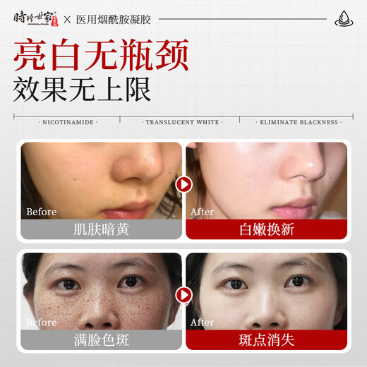 Shizhen Shijia Gold Series Niacinamide Genuine Gel Original Liquid Face Beauty Brightening Essence for Men and Women Official Flagship 3% Special Medical Use