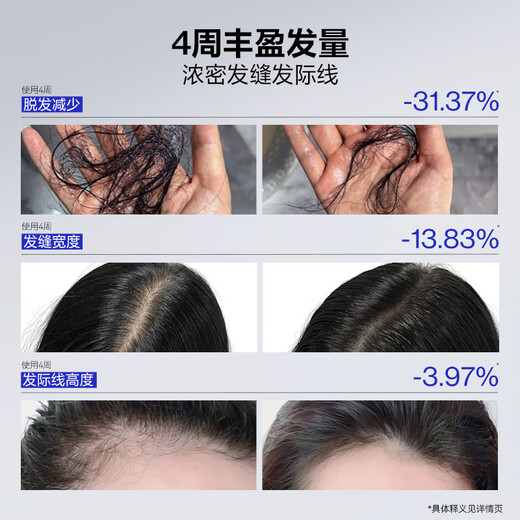 EHD净澈防脱固发精华液滚珠套盒控油舒缓保湿护发男女