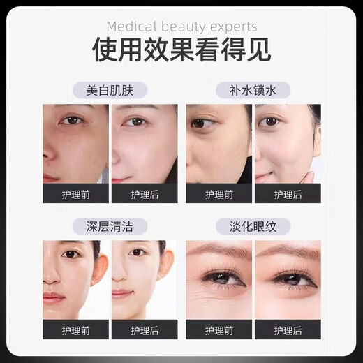 Silver Brown Skin Management Comprehensive Instrument Small Bubble Beauty Instrument Facial Cleansing Blackhead Absorbing Beauty Salon Special Instrument Third Generation Silver Brown Large Bubble Metal Probe + Detection