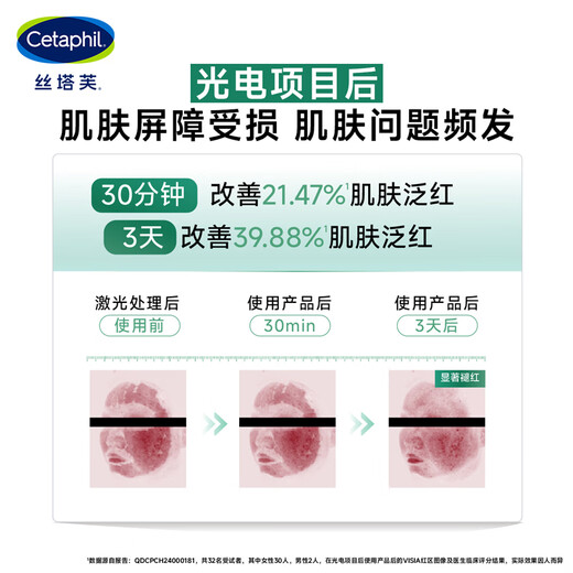 Cetaphil soothing and repairing four-dimensional facial cream 45ml Chen Dulin same style high moisturizing ceramide centella asiatica B5 sensitive skin