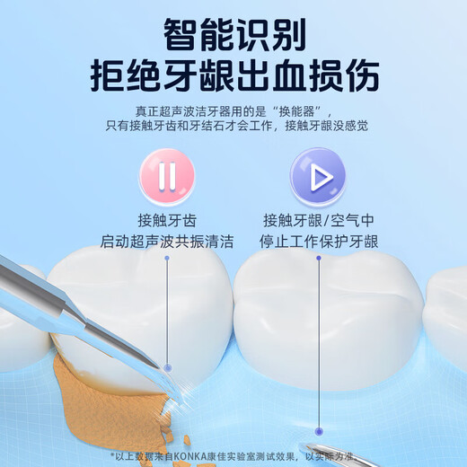 KONKA Ultrasonic Teeth Cleaner Teeth Cleaner Calculus Remover Cleans Teeth and Removes Yellow Teeth Calculus Cleaner Medical Gift Flagship Model - Galaxy Blue True Ultrasonic + Full Set of Teeth Cleaning Tools