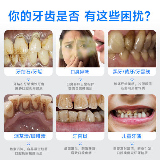 RASW German dental scaler ultrasonic tooth cleaner household dental calculus removal artifact tobacco stains tea stain cleaning cleaning teeth tartar removal scaler tool cleaner gift ceramic white 7500W ultrasonic power + 5 gears + 4 nozzles, fully equipped with upgraded 5 gears, ultra-high frequency Hertz shock cleaning, intelligent gum protection