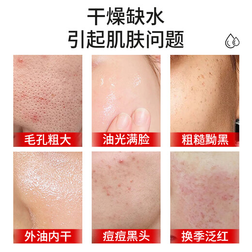 Ba semi-vitamin E milk hydrating, moisturizing and soothing skin lotion, moisturizing, mild and non-irritating, unisex, 100ml 3 bottles, high moisturizing vitamin E milk