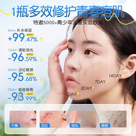 ORGINESE Youth Face Cream 12-18 Years Old Boys and Girls Adolescent Oil Control Moisturizing Acne Student Skin Care Products Autumn Winter Christmas