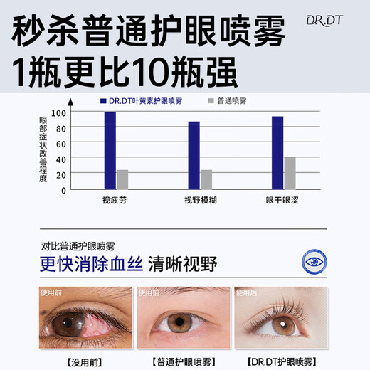 DR.DT French Lutein Eye Protection Spray Eye Wash Relieves Eye Fatigue Itching Dryness Blurred Vision Non-Eye Drops