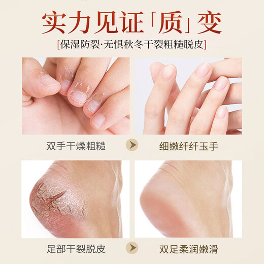 Xiting Horse Oil Anti-Crack Cream for Dry Hands and Feet, Cracked Hands and Heels, Rough Moisturizing Moisturizing Cream 50g 2 Bottles Horse Oil Anti-Crack Hand and Foot Cream