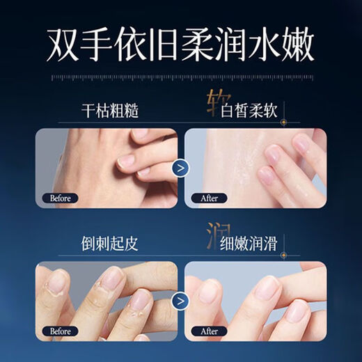 377 Whitening Hand Essence Cream, Rejuvenating and Beautifying Skin, Moisturizing, Whitening and Moisturizing Autumn and Winter Hand Cream, Whitening Hand Cream 80g*1