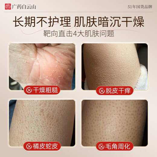 Baiyunshan anti-itch body lotion hydrates and moisturizes the whole body for itchy skin, dry and peeling skin, antibacterial and moisturizing body lotion for autumn and winter, buy 1 get 1 free, specializes in dry and itchy moisturizing