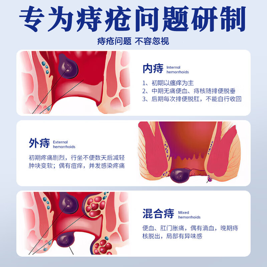 Yunnan Materia Medica Fungi King relieves itching and breaks itching official genuine skin itching dermatitis eczema infection non-ointment 20g