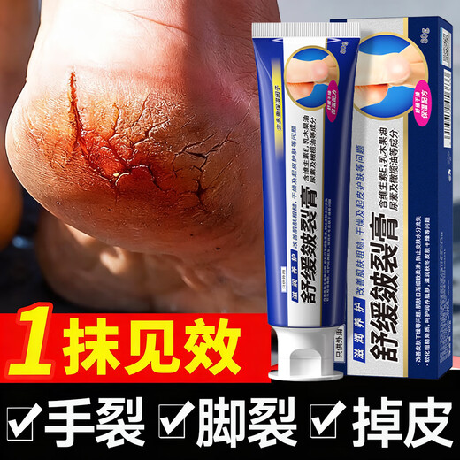 BEAUTY NOTES Cracked Cream Hand and Foot Anti-Crack Cream Cracked Feet Cracked Hands Cracked Heels Cracked Skin Cream Cracked Foot Cream 80g