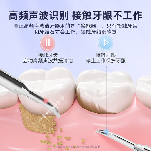 RASW German dental scaler ultrasonic tooth cleaner household dental calculus removal artifact tobacco stains tea stain cleaning cleaning teeth tartar removal scaler tool cleaner gift ceramic white 7500W ultrasonic power + 5 gears + 4 nozzles, fully equipped with upgraded 5 gears, ultra-high frequency Hertz shock cleaning, intelligent gum protection